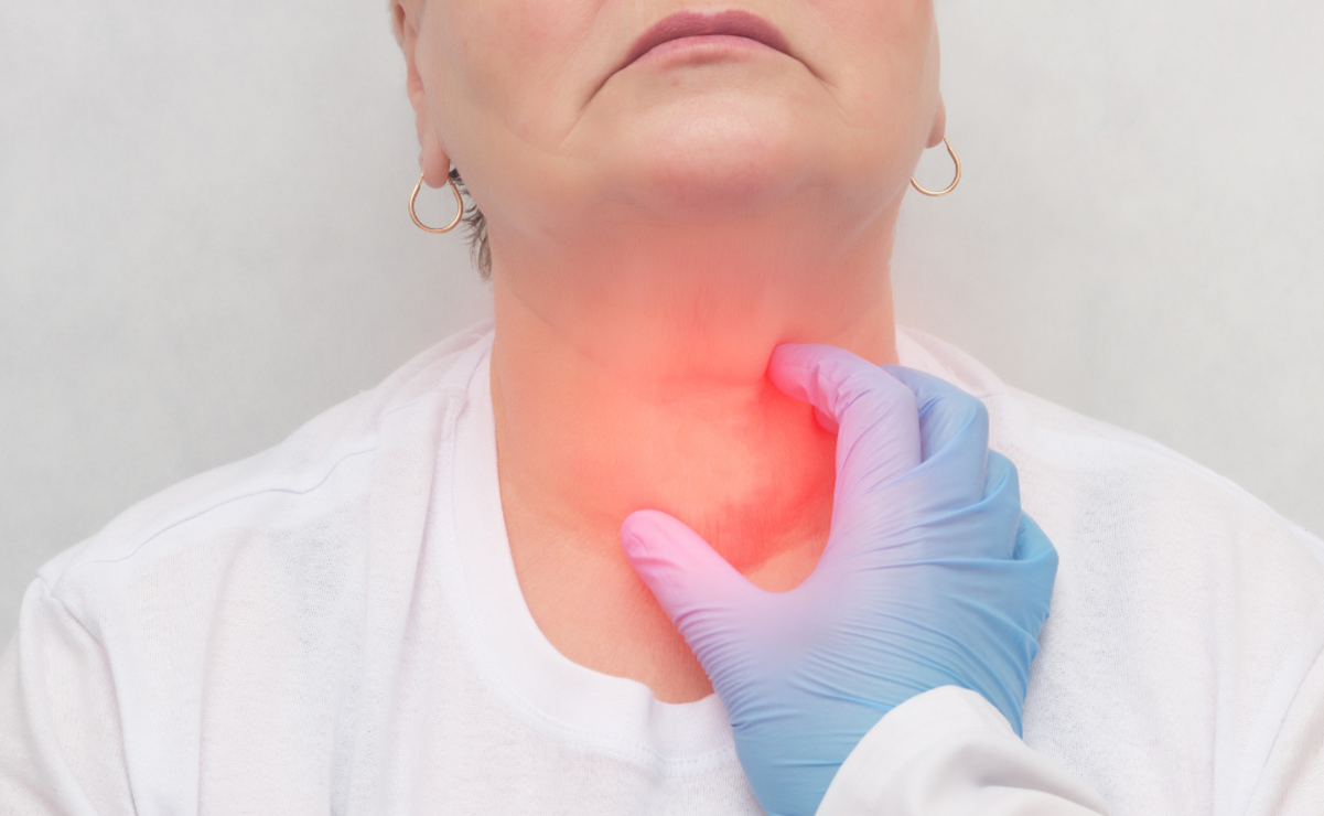 Cancer de cabeza y cuello: factores de riesgo que debes conocer